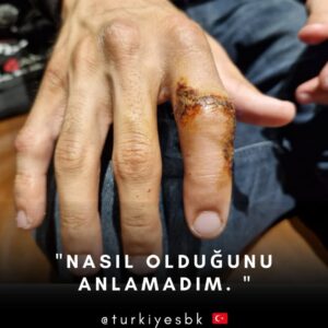 Toprak Razgatlıoğlu, Fotoğraf: TurkiyeSBK