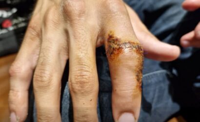 Toprak Razgatlıoğlu, Fotoğraf: TurkiyeSBK