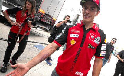 Racing team member in a red shirt shows an arm injury as photographers film him in a pit area.