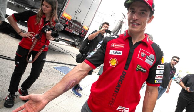 Racing team member in a red shirt shows an arm injury as photographers film him in a pit area.